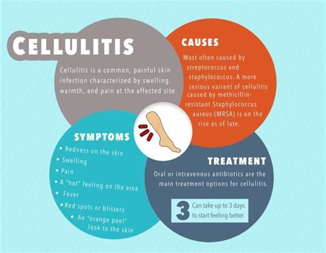 What Is Cellulitis Symptoms Causes And Treatments For Cellulitis