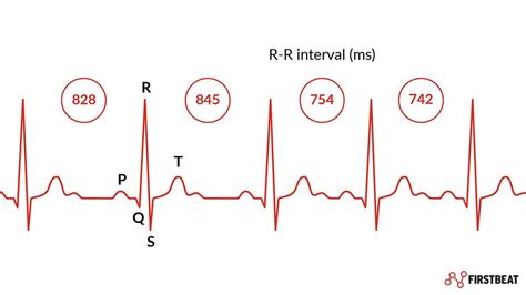 What Is Heart Rate Variability Hrv And Why Does It Matter Firstbeat Blog