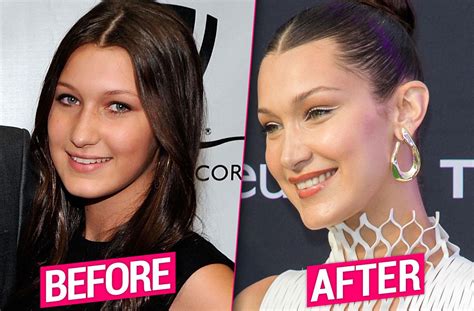 bella hadid supermodel s denial of plastic surgery may be a lie
