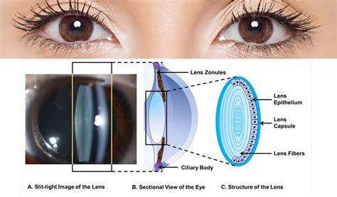 Lensa Mata Anatomi Fungsi Dan Daya Akomodasi National Eye Center