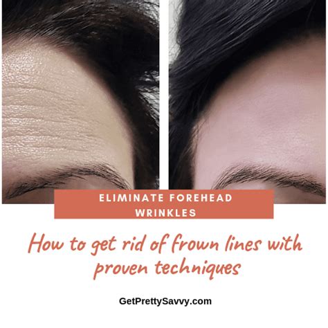 How To Get Rid Of Frown Lines Getprettysavvy Deep Forehead Wrinkles