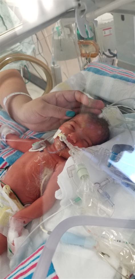 Baby Girl Was Born At 30 Weeks July 2018 Babies Forums What To Expect