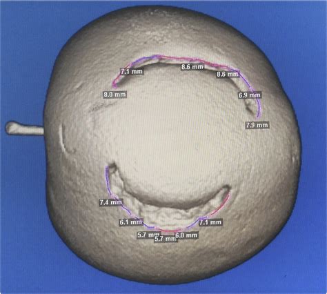 3d Image Of Apple With Bite Marks Of Teeth Download Scientific Diagram