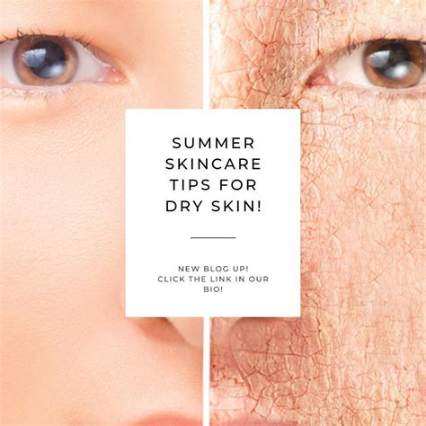 Summer Skincare Tips For Dry Skin Dry Skin Skin Care Diy Beauty Secrets