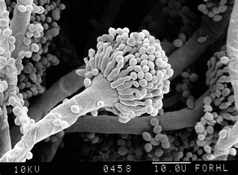 Aspergillus Fumigatus Conidia Close Up Sem Wellcome Collection
