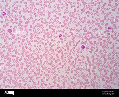Human Blood Smear Light Micrograph Hi Res Stock Photography And Images