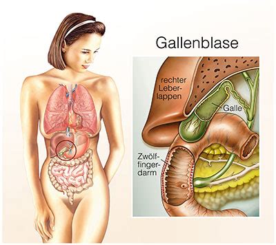 Gallenblasenentzündung Ursachen Symptome Behandlung MedLexi de