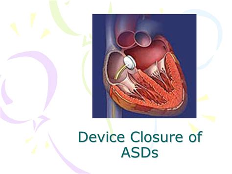 Cvt Mohd Farid Asd Closure For Cardiovascular Technologist