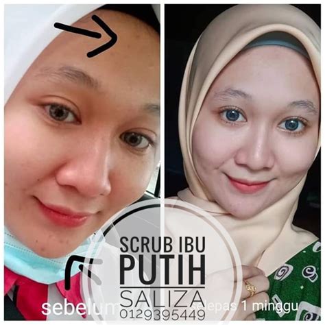 Khasiat krim ibu putih nina skincare ~ boleh digunakan bersama krim malam (untuk muka) dan lotion (untuk badan) ~ kesan ternyata sangat nyata walupun 1 kali penggunaan. SCRUB IBU PUTIH | SALLYZA MANN . BLOGSPOT.COM