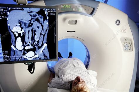 Ct Scanning Stock Image M4100380 Science Photo Library