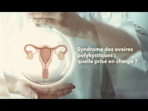 Syndrome Des Ovaires Polykystiques Quelle Prise En Charge Youtube