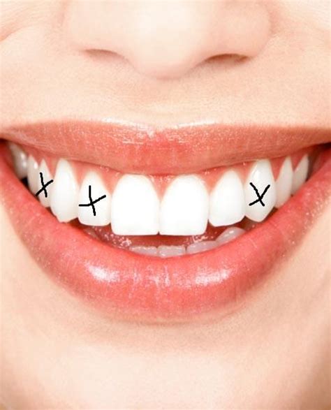 Nach einer sorgfältigen diagnose bespricht der zahnarzt mit dem patienten die einzelnen schritte. Ich hasse diese Zähne, und meine Zahnspange! (Zahnlücke)
