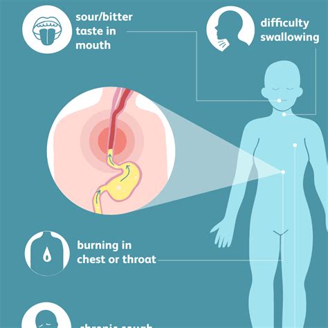 All of the sudden meaning. What Causes Bad Acid Reflux And Heartburn