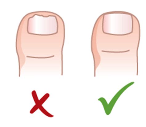 Caring for your child's feet - BabyCentre UK