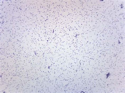 Eisco Prepared Microscope Slide Staphylococcus Aureus Gram Positive