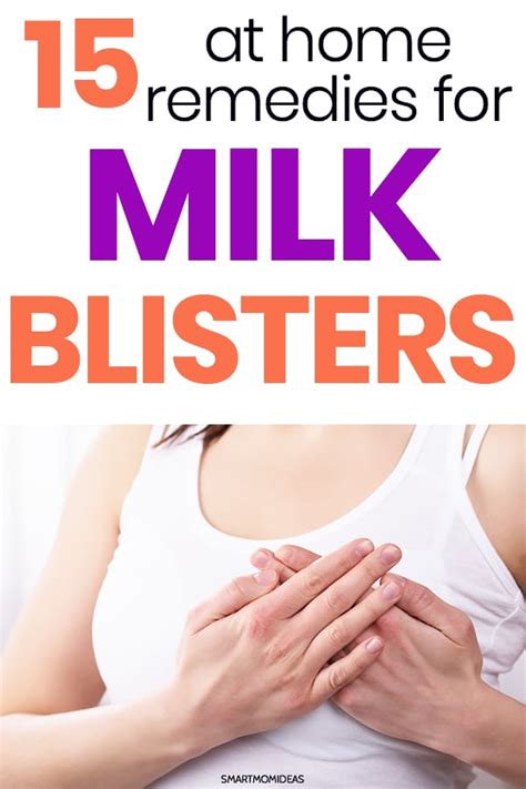 15 Tips For Treating Milk Blisters Smart Mom Ideas