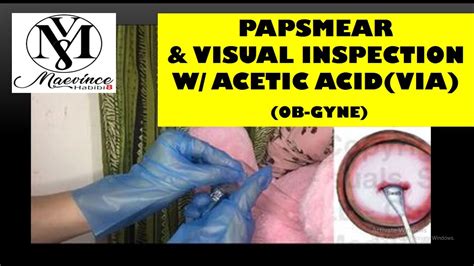 Medicine Vlog Ob Pap Smear Visual Inspection W Acetic Acid Via