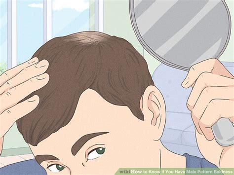 3 Ways To Know If You Have Male Pattern Baldness Wikihow
