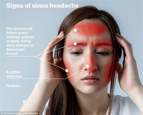 Not All Headaches Feel The Same Handy Picture Guide Shows Daily Mail