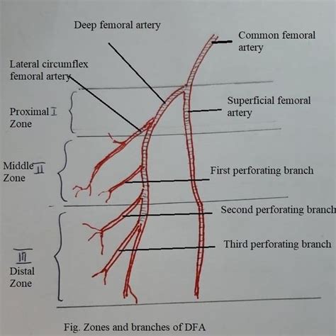 Zones And Branches Of Deep Femoral Artery Download Scientific Diagram