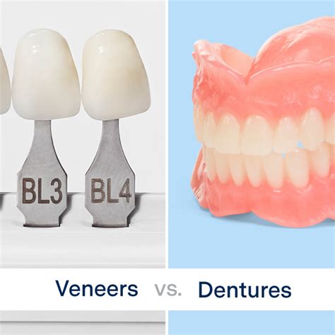 Veneers Vs Dentures Choosing The Best Solution