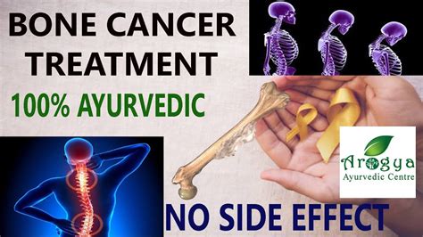 They can include swelling, lameness, and joint or bone pain. Bone cancer : causes, types, effects, symptoms, treatment ...