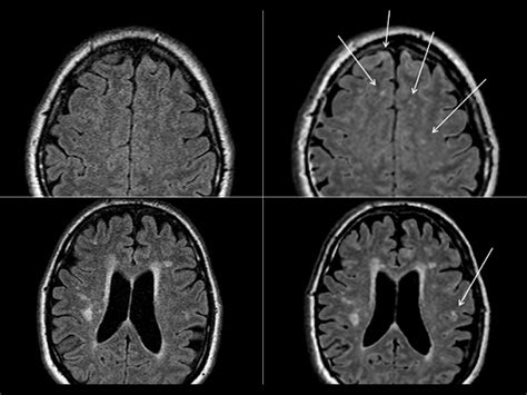 Synthetic Mri Images Are They Valuable For The Evaluation Of Multiple