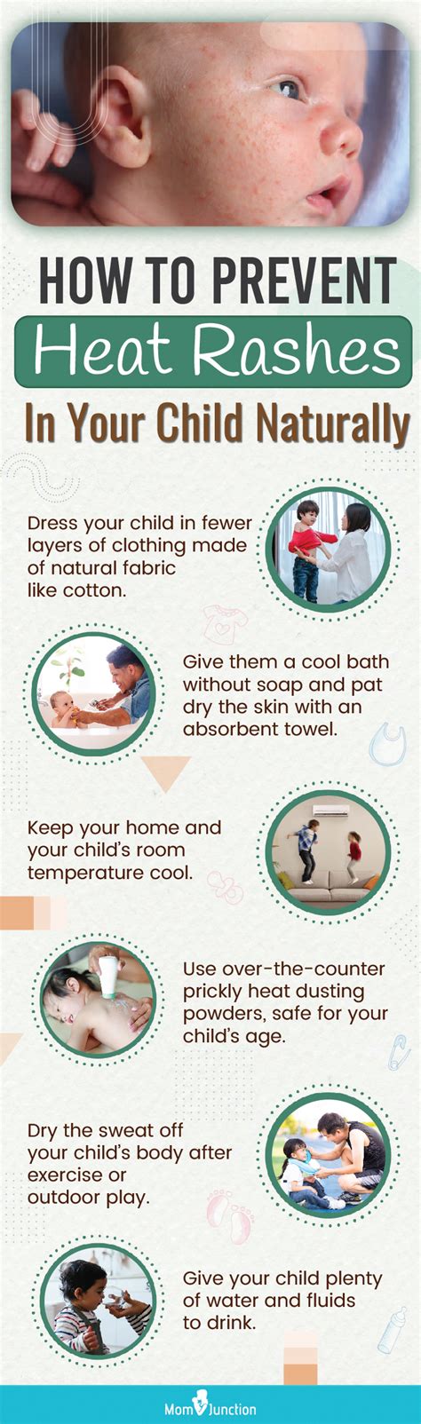 Heat Rashes In Children How To Treat And Prevent Them