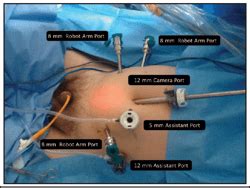 Robot Assisted Radical Prostatectomy How I Do It Part I Patient Preparation And Positioning
