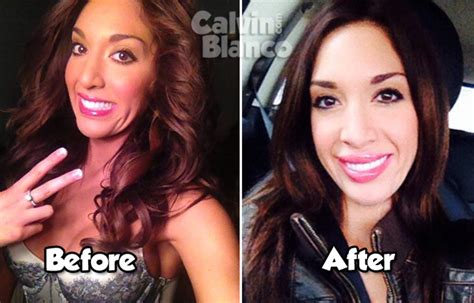 Farrah Abraham Before And After Lips