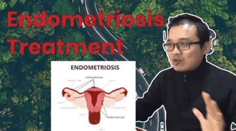 Endometriosis news is strictly a news and information website about the disease. Endometriosis Treatment - Best Acupuncture Hamilton NZ