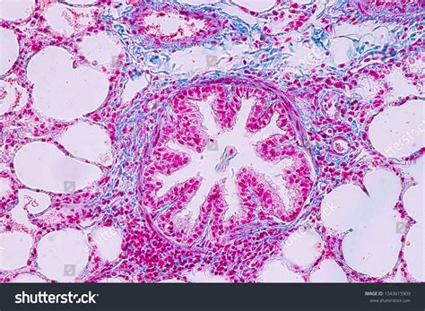 Concept Of Education Anatomy And Human Lung Tissue Under Microscope