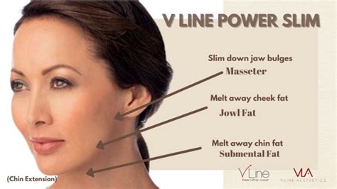 Non Surgical Face Slimming V Line Aesthetics