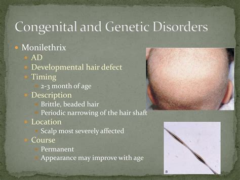 Ppt Disorders Of Pigmentation Powerpoint Presentation Free Download