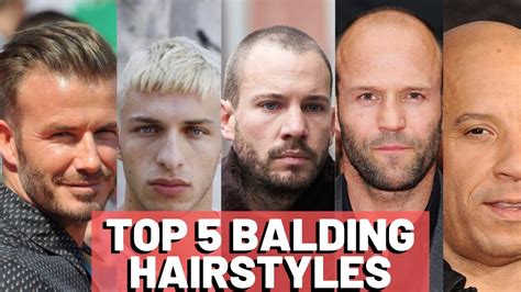 100 Haircuts And Hairstyles For Balding Men On Top And