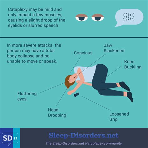 Narcolepsy Symptoms Cataplexy