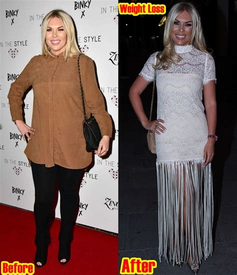 Towie Frankie Essex Weight Loss Diet Workouts Before And After Photos 2018 Plastic Surgery