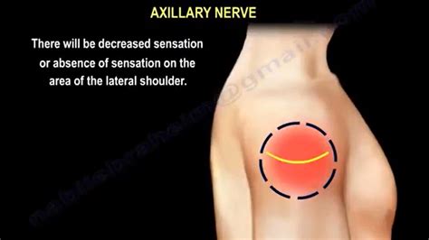 Axillary Nerve Injury Causes Symptoms Diagnosis And Treatment