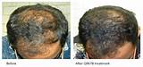 Photos of Hair Treatment Doctor In Mumbai