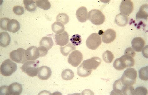 Foto Gratis Malariae Schizonte Normale Dimensione
