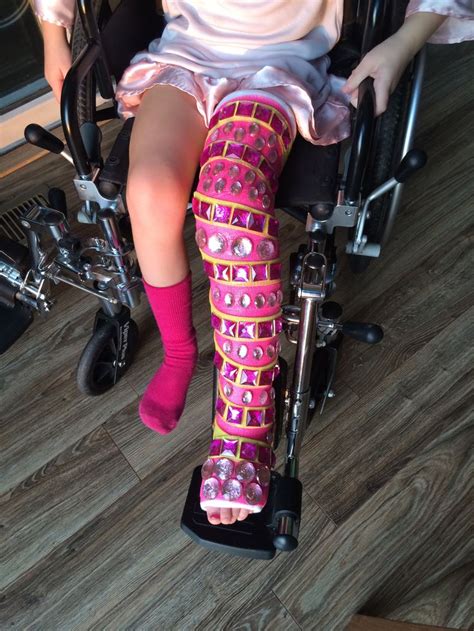 27 best images about Fabulous Leg Casts on Pinterest | Henna, Leopards