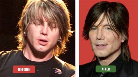 Did John Rzeznik Has Undergone Plastic Surgery Everything You Need To Know
