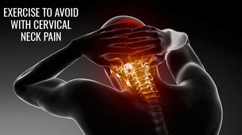 But the effect of mobilization upon the bulged nucleus or annulus with the entrapment of nerve roots is not scientifically proved. Exercises to avoid with cervical neck pain - YouTube