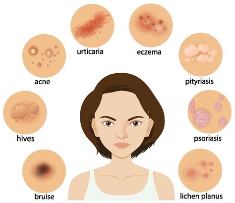 Diagram Showing Different Skin Conditions Stock Image Vectorgrove