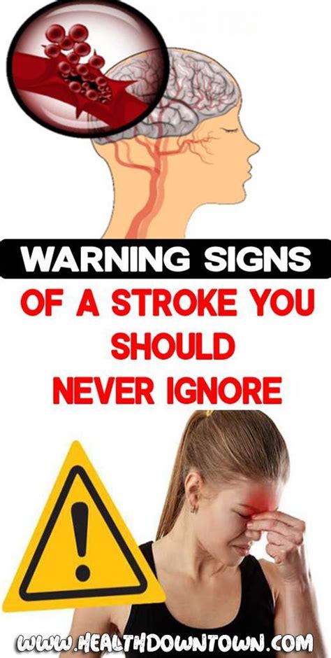 Stroke 8 Warning Signs Do Not Ignore Them Stroke Risk Factors
