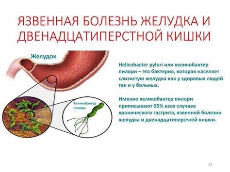 Диета язва двенадцатиперстной Язва Желудка И Двенадцатиперстной Кишки Симптомы Лечение И Диета Язва Желудка И Двенадцатиперстной Кишки Симптомы Лечение И Диета Диета язва двенадцатиперстной