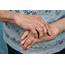 Muscle Pathology In Rheumatoid Arthritis The Effects Of Inflammation 