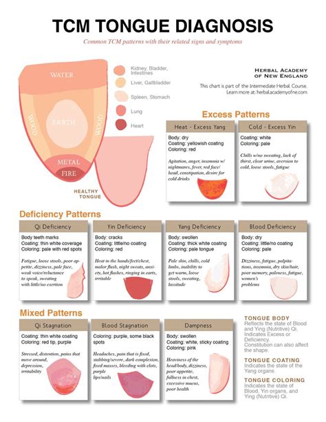Tcm Tongue Diagnosis Mtc Teoria I Diagnòstic Pinterest Muscle