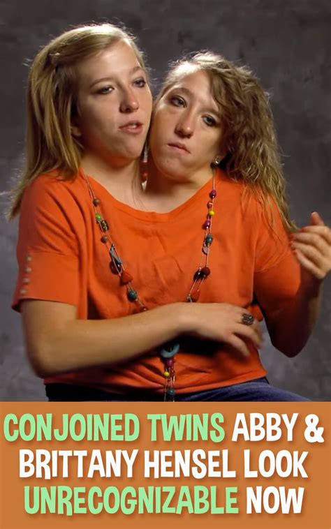Conjoined Twins Abby And Brittany Hensel Look Unrecognizable Now Conjoined Twins Brittany The