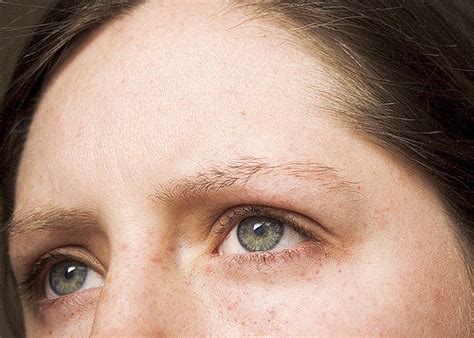 Hey gets i hope this video can help u learn how to make your freckles go away. Red freckles? | g.design | journal